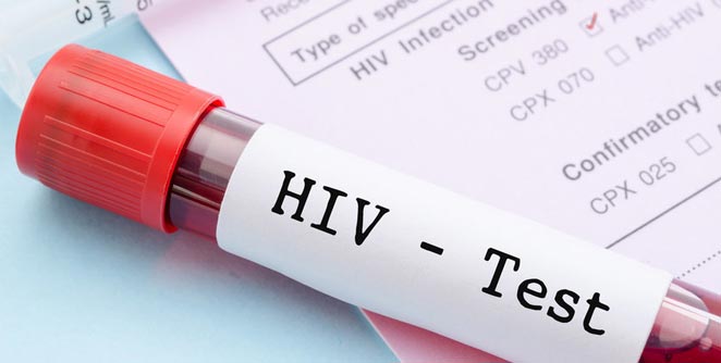 http://www.vsnews.co.in/upload/2018-02-07/27839165hiv.jpg